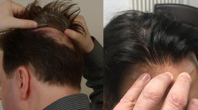 Какие существуют способы установки и особенности крепления системы волос