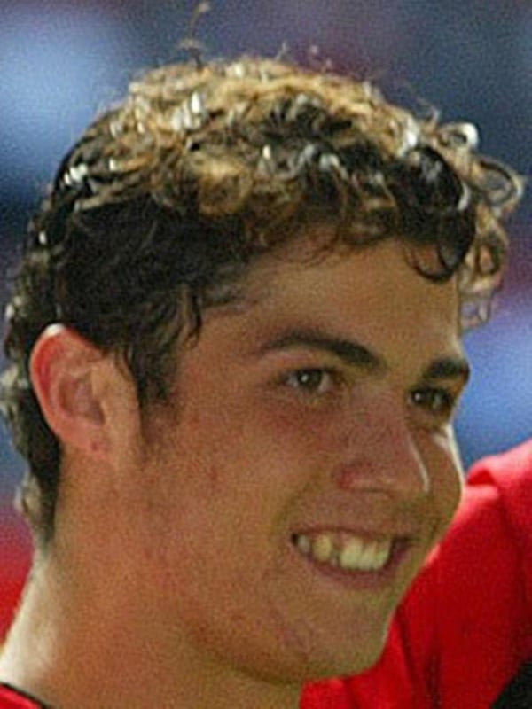 cristiano-ronaldo-before-and-after-his-surgeries-and-v0-9w4f7ilgf9ac1.jpg